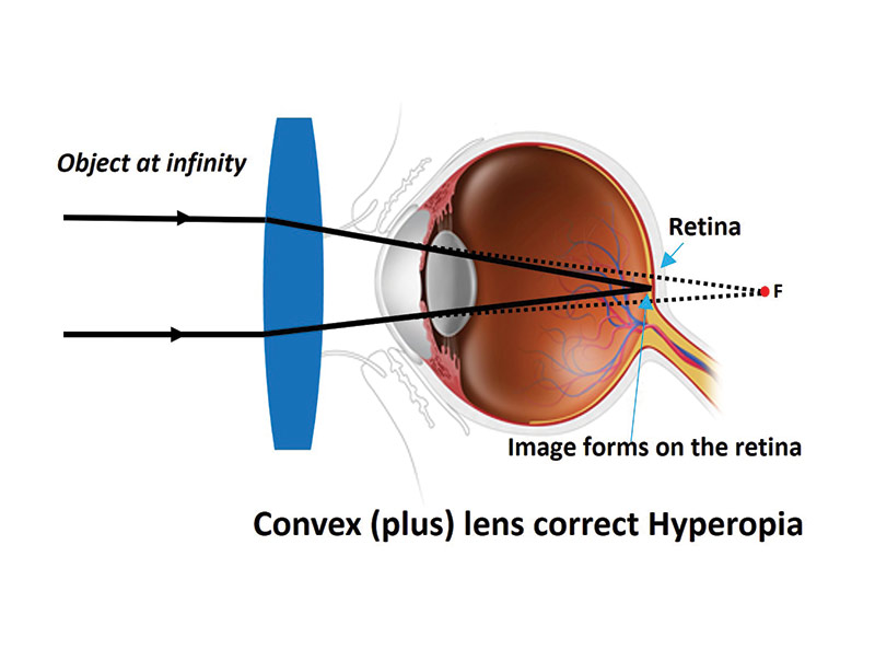 Retina Imaging  Village Optical